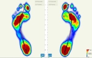 foot scanning