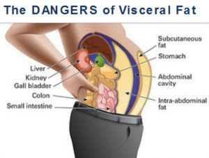 visceral-fat