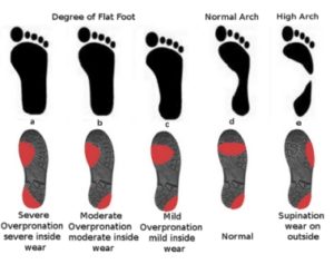 lgr-prep-article-3-footwear-pattern